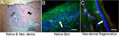 Pulmonary Visceral Pleura Biomaterial: Elastin- and Collagen-Based Extracellular Matrix